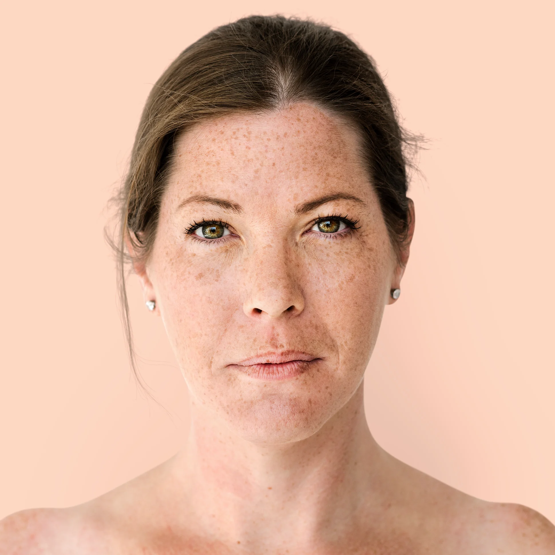 Dark Spots & Uneven Tone
