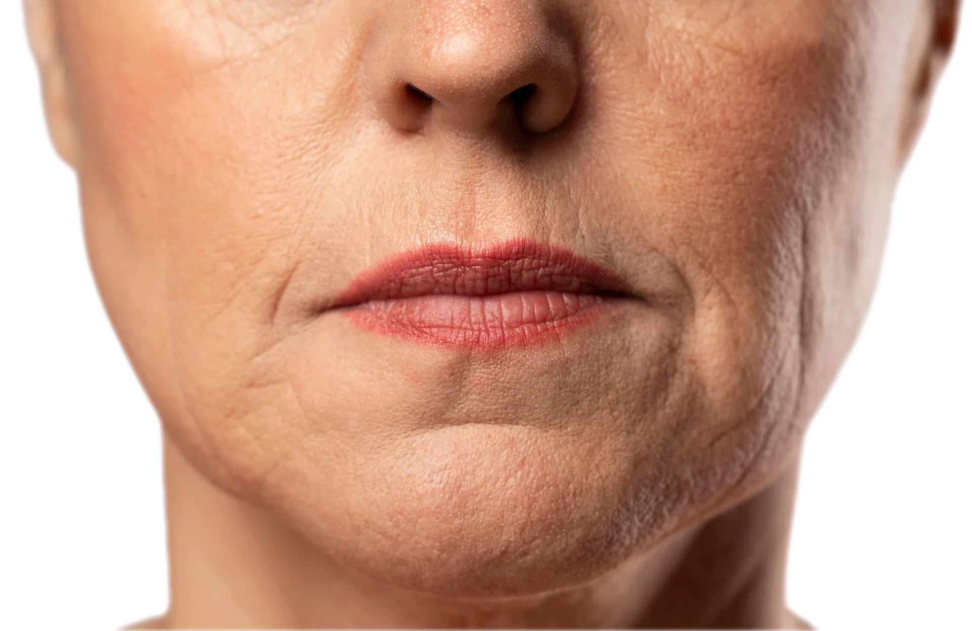 Fine Lines & Aging Skin