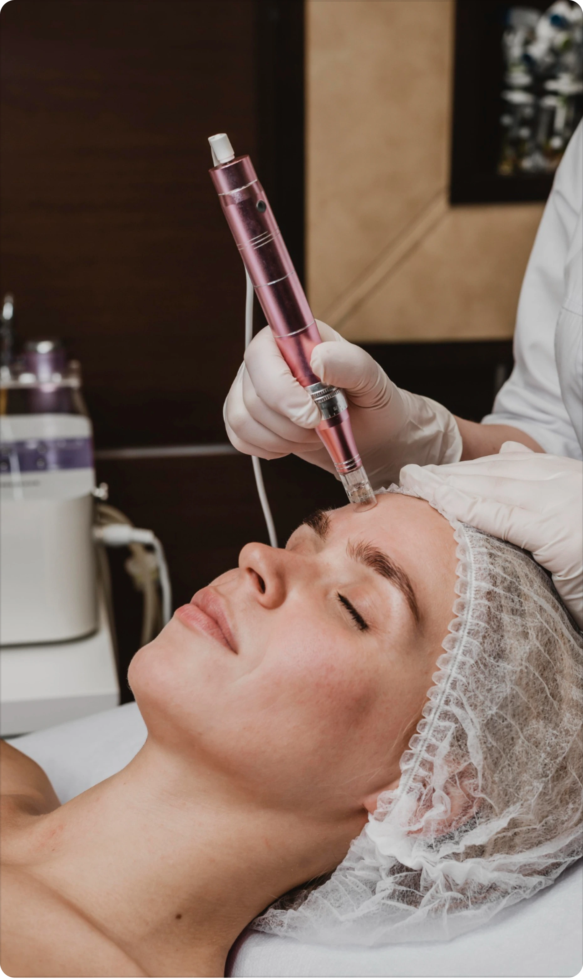 SkinPen treatment details