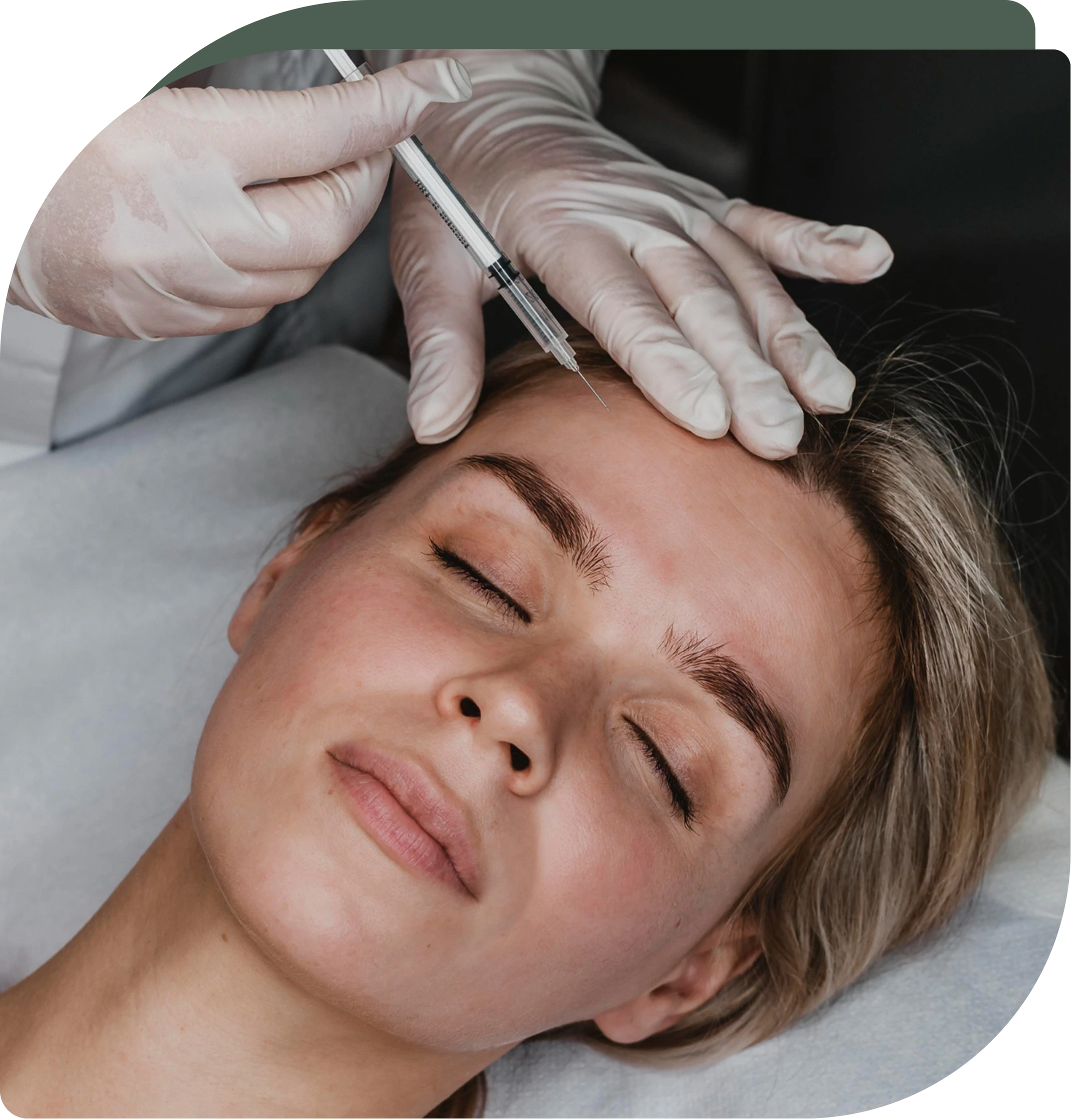 Morpheus8 Questions Lake Nona Patients Ask Us