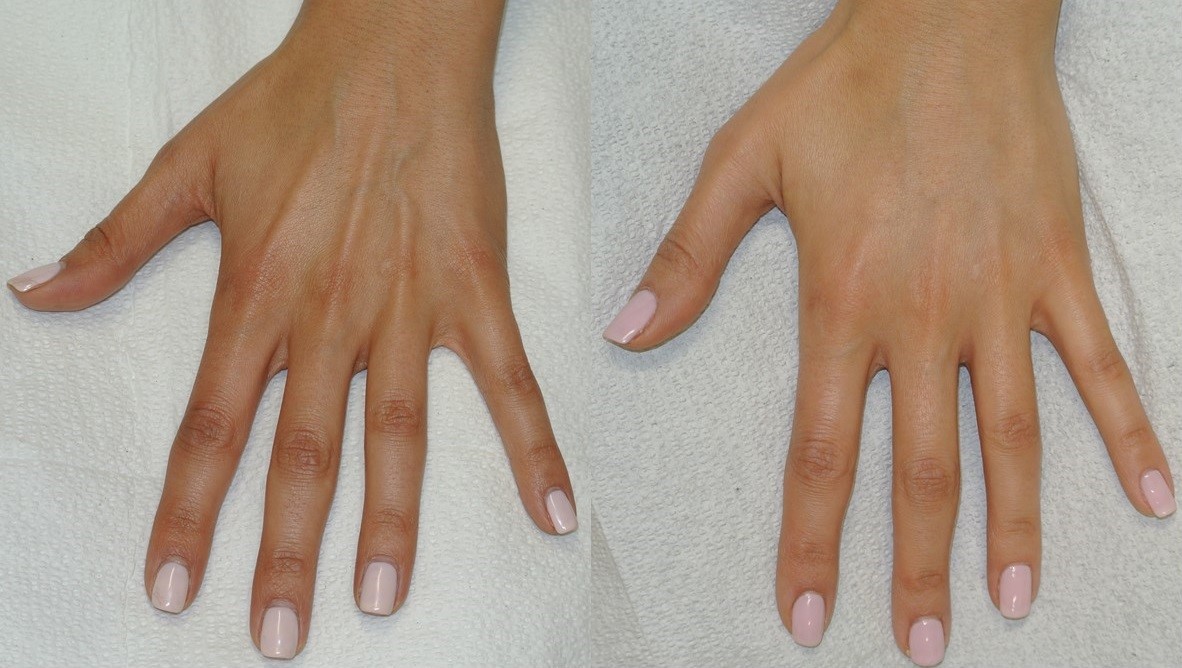HANDS