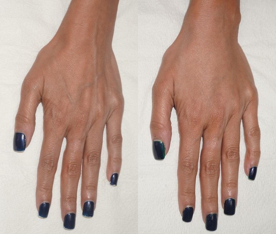 HANDS