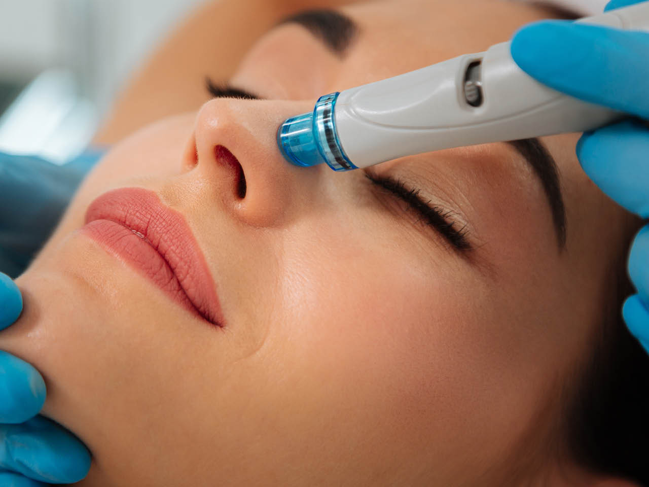 Hydrafacial in Orlando, FL