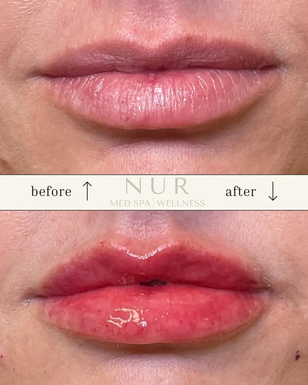 Lip filer with smooth texture