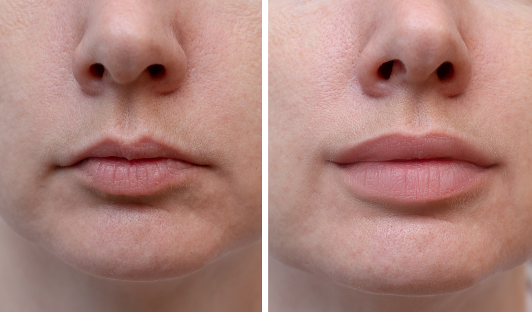 LIPS